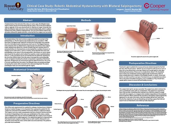 Surgical Illustration Research Poster by Jenny McCabe, 2018 Adobe Photoshop/InDesign and Illustrator